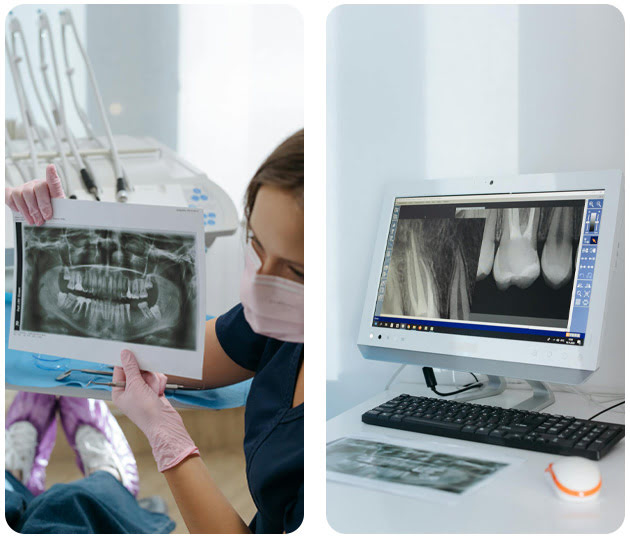 sippacs-pacs-radiology-sonograghy-graphic-software