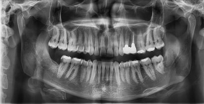 radiology-OPG-pacs