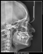 radiology-OPG-pacs