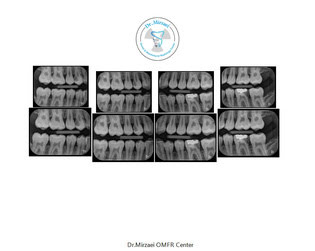 radiology-OPG-pacs