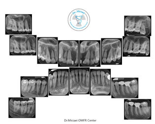 radiology-OPG-pacs