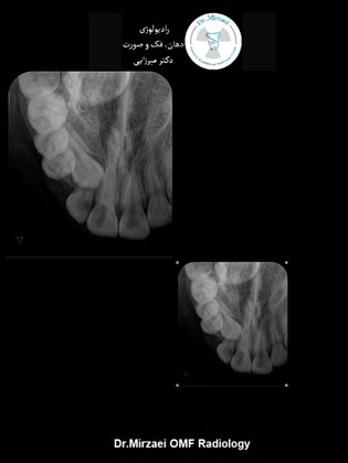 radiology-OPG-pacs