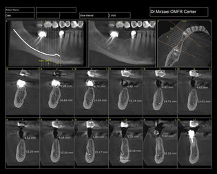 radiology-OPG-pacs